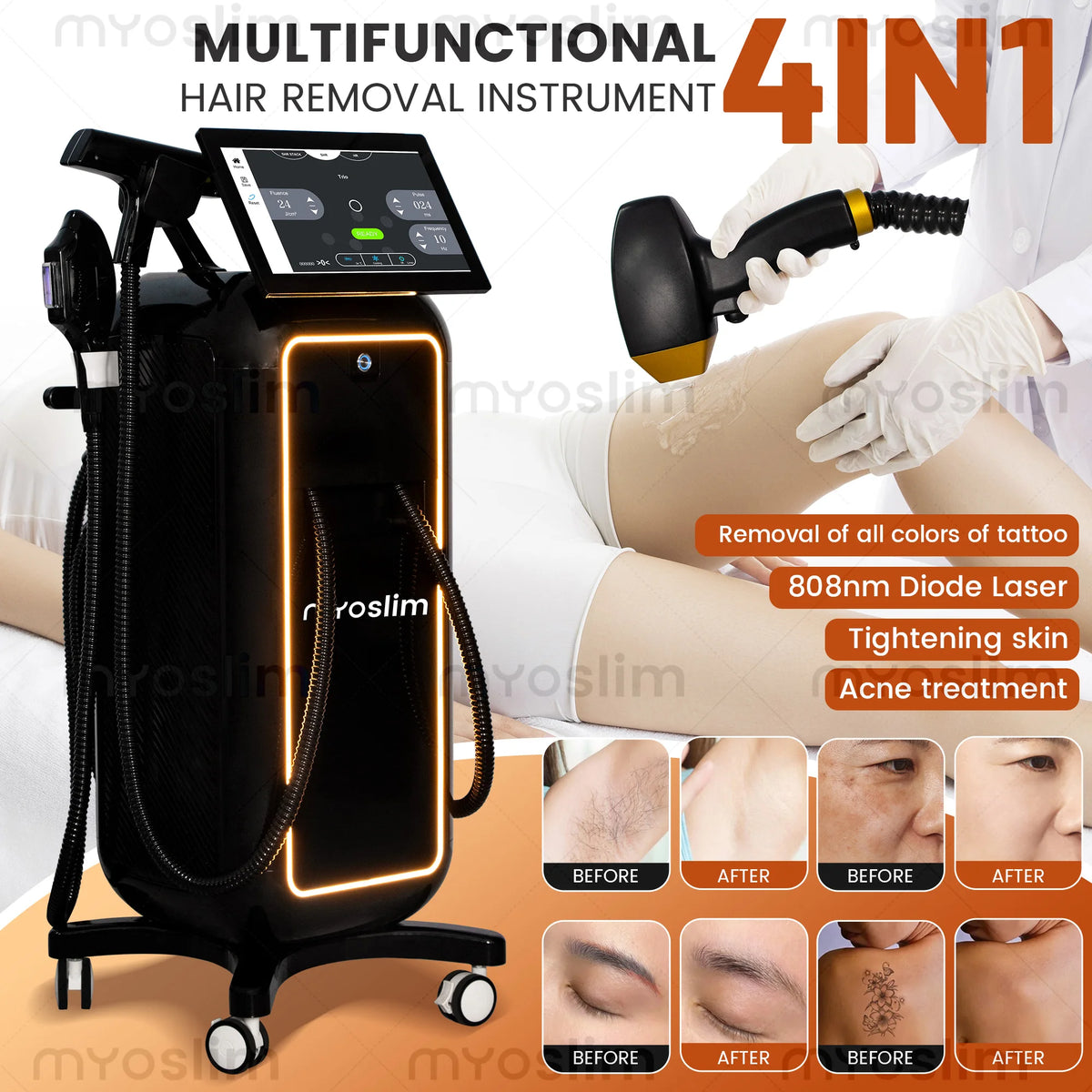 Myoslim Diode Laser Hair Removal Machine For Professional Use