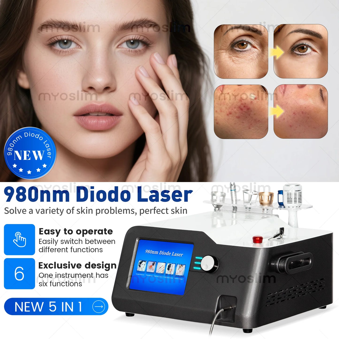 TAIXL 30W 5in1 Capillary Removal Laser For Spider Veins