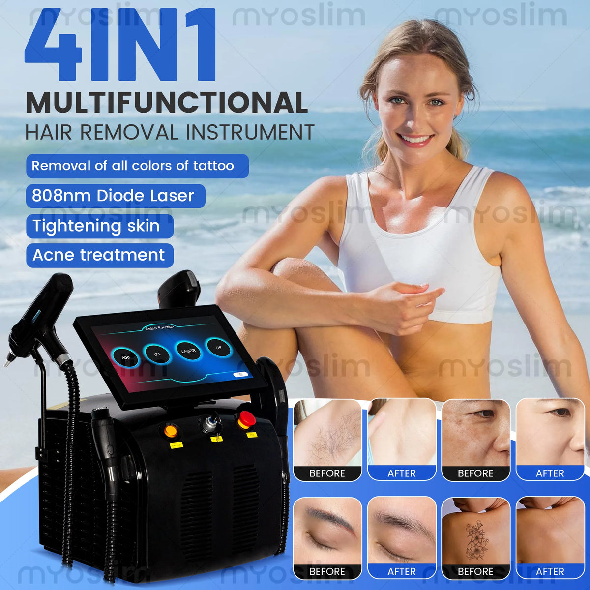 Professional 808nm Diode Laser System For Hair Tattoo Removal