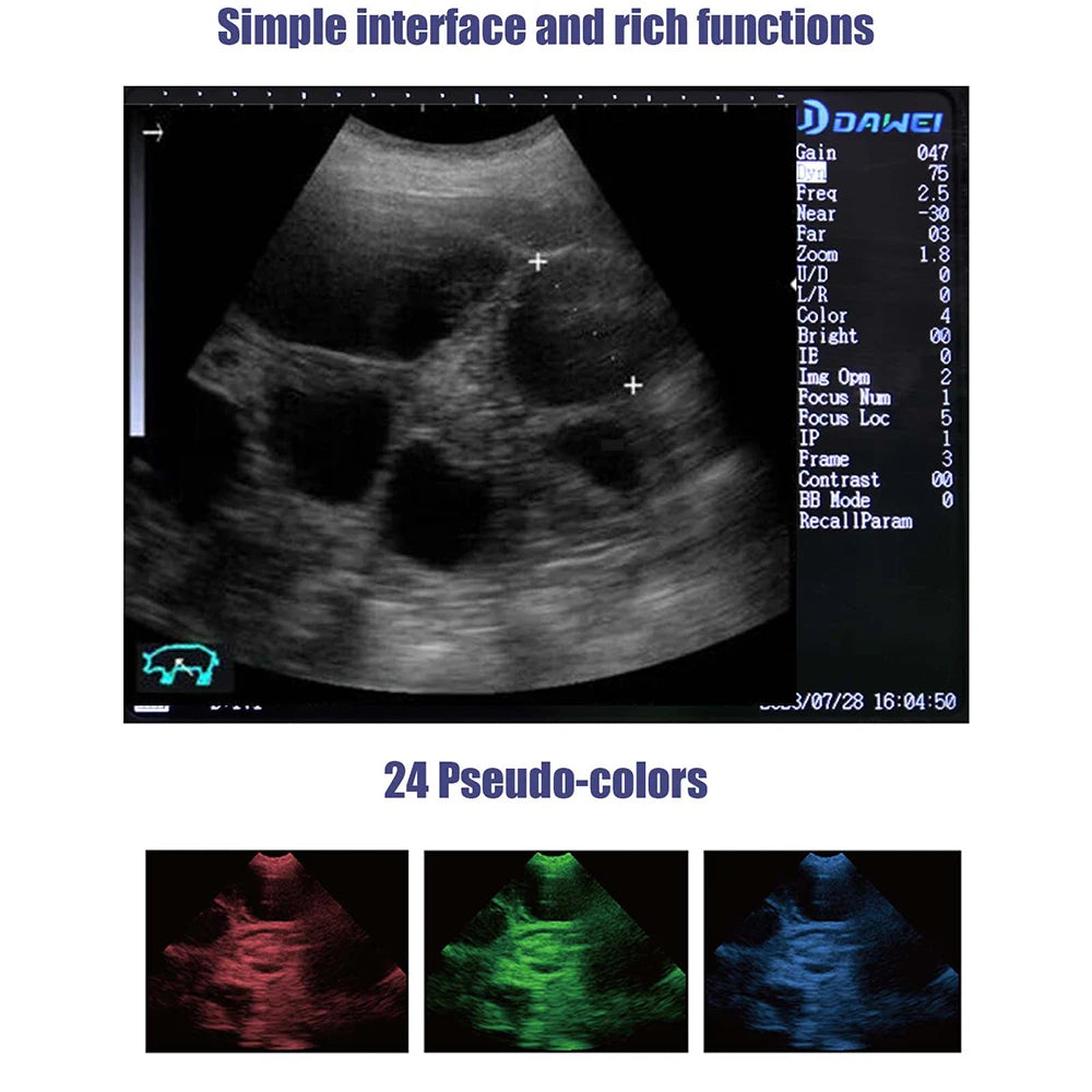 Dawei Portable Veterinary Ultrasound Scanner For Livestock
